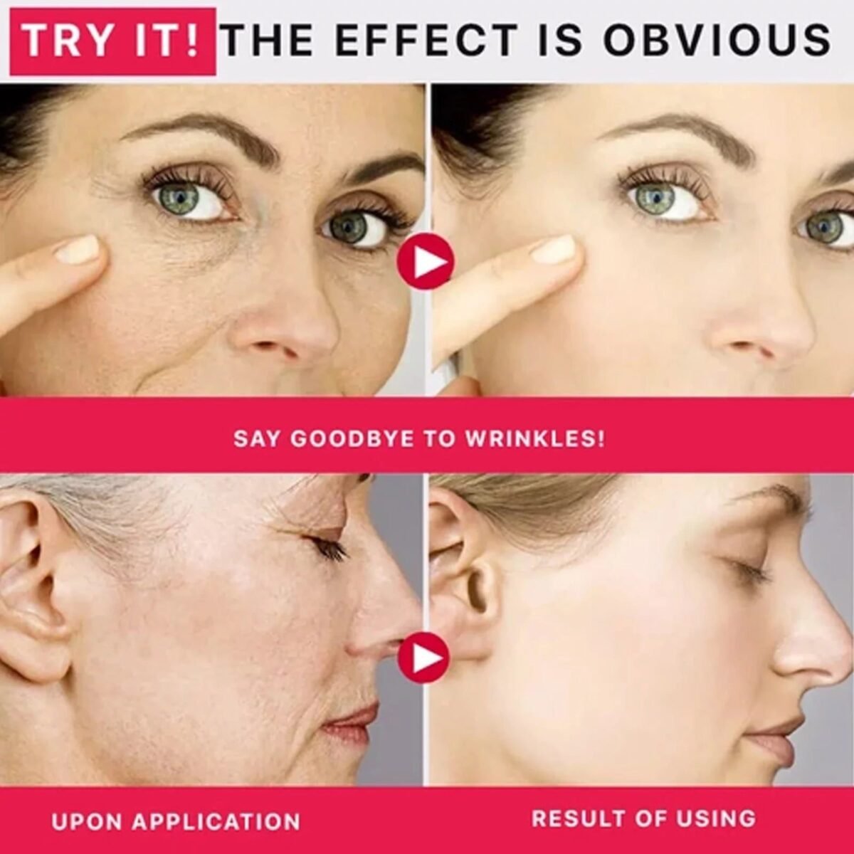 Lighten Wrinkles Thread Needle: Compact Size and Collagen Filler