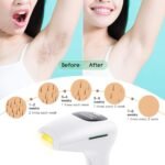 IPL Hair Removal System, Hair Remover 500,000 Flashes Permanent Painless for Face Bikini Underarms and Body - Image 6